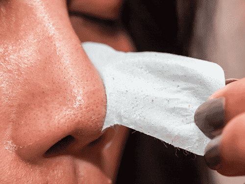 How to remove blackheads from the nose
